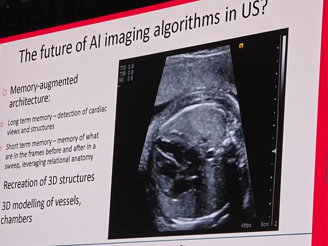 ISUOG 2025 Cancún - Le futur de l'échographie fœtale cardiaque: évolution ou révolution ?